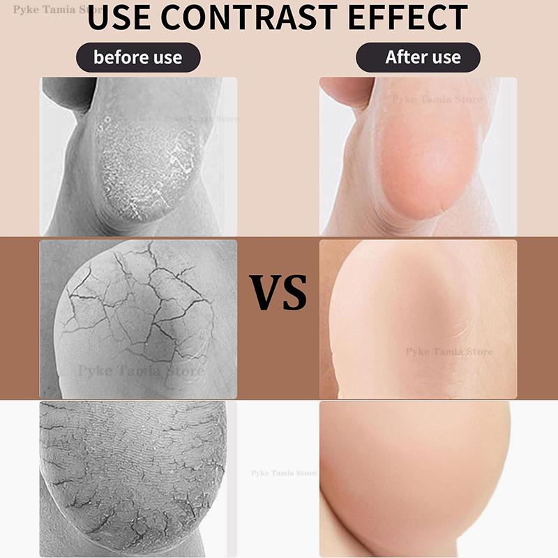 2pcs Heel Protective Cover Silicone Feet Care Anti-Crack Pain Relief Moisturizing Socks Men Women Shoe Cushion Insoles Inserts