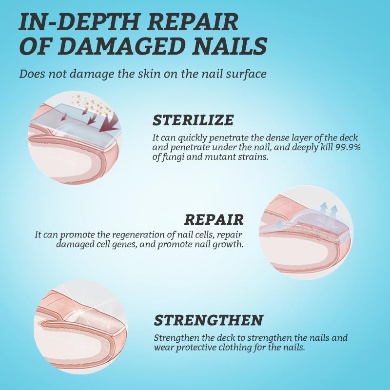 RtopR Antibakterielles ätherisches Ingwer-Nagelöl fördert das Wachstum und die Reparatur der Nägel