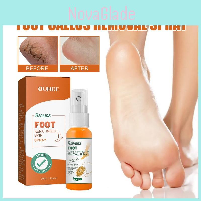 Nourishing Ouhoe Foot Spray For Softening Calluses And Cracked Heels 30ml