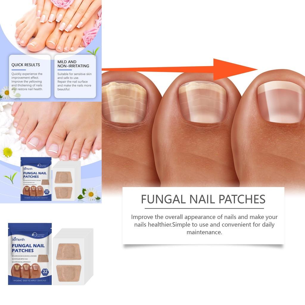 Ximonth Nail Care Patches Gentle Repair And Daily Cleanse For Healthy Nails