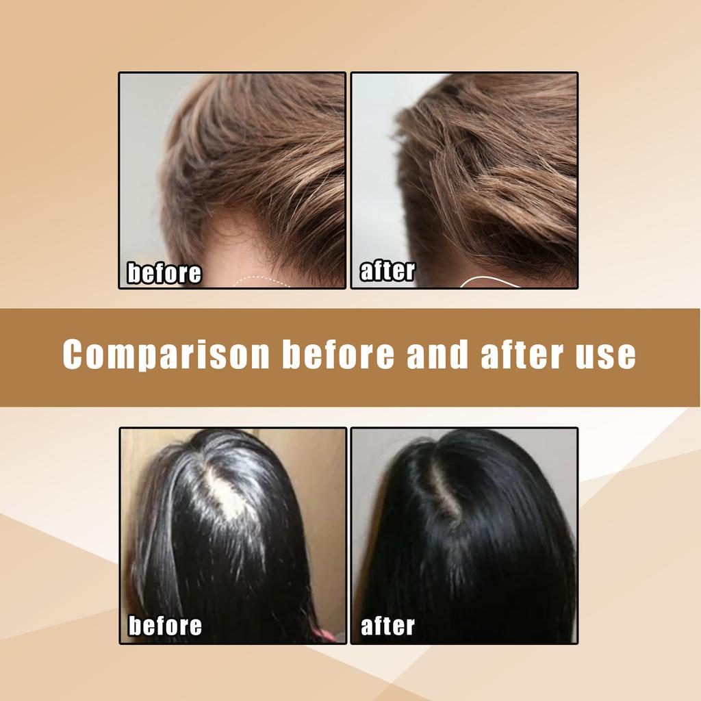Shampoo Soap, Refreshing Anti-dandruff, Oil-free Care, Smoothing Hair, Nourishing Scalp, Shampoo Soap For All Hair Types