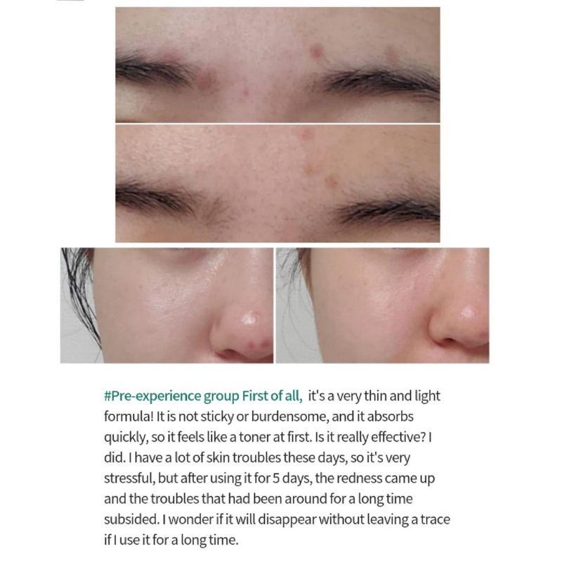 60pcs/60ml_[INNISFREE] Retinol Cica Repair Ampoule 1ml (Sample Sachet)