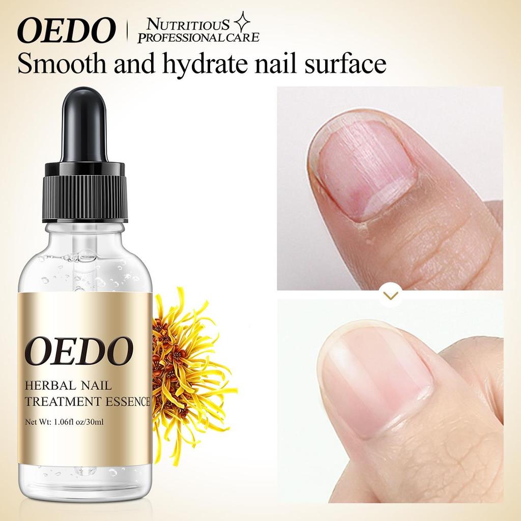 OEDO Herbal Nail Treatment Essential Oil Hand and Foot Whitening Toe Nail Removal Feet Care Polish Nail Gel Nail Repair Treatment