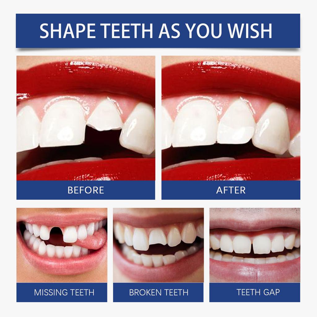 Resin Tooth Repair Glue Shapeable Teeth Gaps Filling Solid Glue Temporary Tooth Repair Safe DIY Emergency Dental Supplies 2028