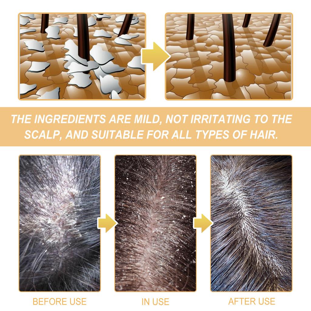 Rice Anti Shedding Shampoo Deeply Cleanses, Moisturizes, and Repairs Hair Roots, Strengthens Hair, and Prevents Loss of Dense Hair