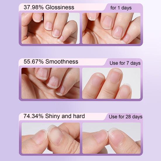 Cuticle Oil Pen with Ceramic Tip Dead Skin Remover Nail Care Pen Nutrition Moisturizing Hydrating Cuticle Oil And Ceramic Pusher Nail Treatment