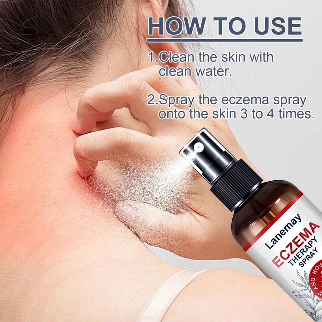 Eczema Therapy Spray-Eczema Treatment-Reduce Itchness And Redness-Prompte New Skin Cell Renewal, 100ml