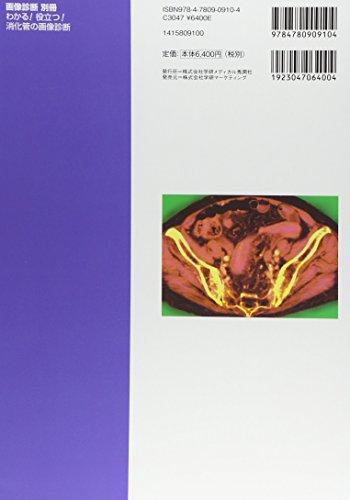 Easy To Understand and Useful! Digestive Tract Imaging Diagnosis (Keybook Special Edition of Imaging Diagnosis)
