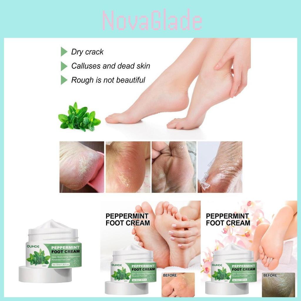 Ouhoe Moisturizing Foot Cream Rich Healing Formula For Dry Cracked Heels And Skin