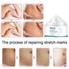 Smoothing Skin Stretch Mark Cream, Gentle and Non-irritating, Smooths Wrinkles and Fades Fine Lines