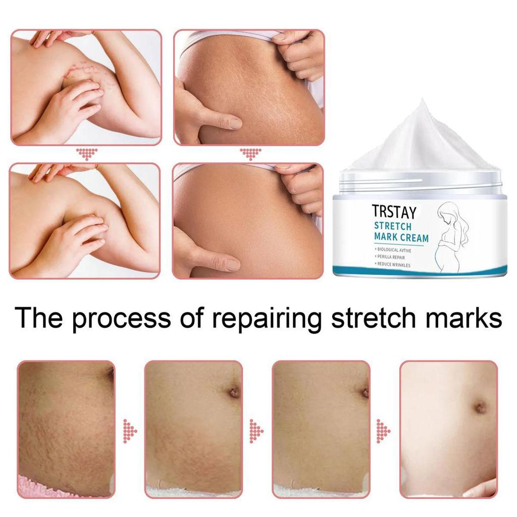 Smoothing Skin Stretch Mark Cream, Gentle and Non-irritating, Smooths Wrinkles and Fades Fine Lines