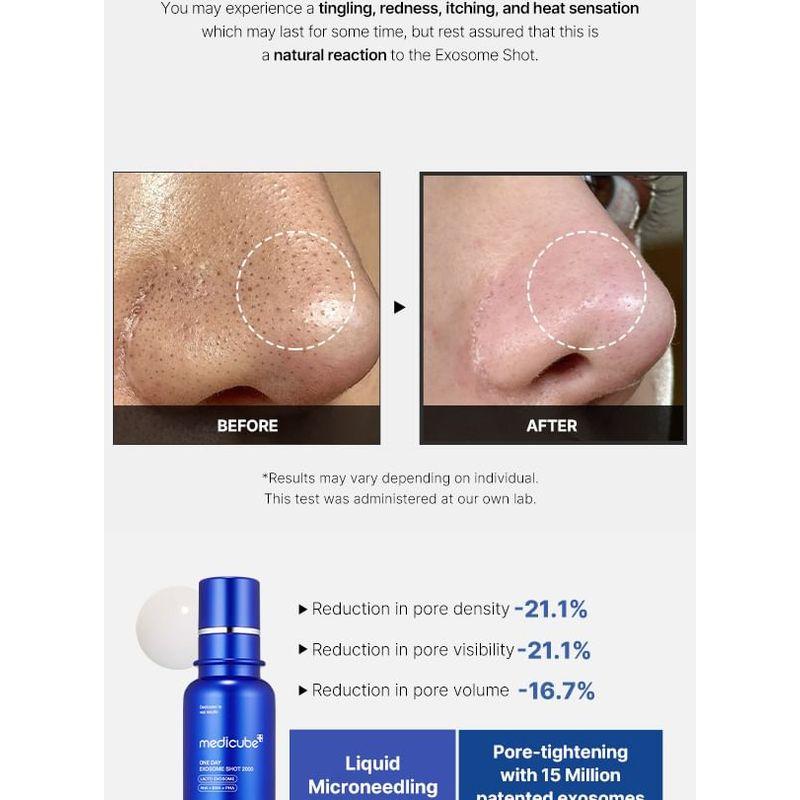 medicube - One Day Exosome Shot Pore Ampoule 2000