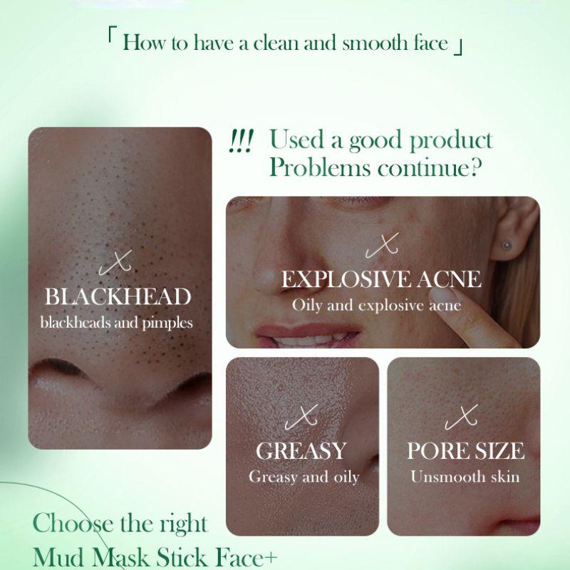 40g Mugwort Mud Mask Stick, Deep Cleansing, Removes Acne And Blackheads, Gently Repairs The Skin, Controls Oil And Moisturizes
