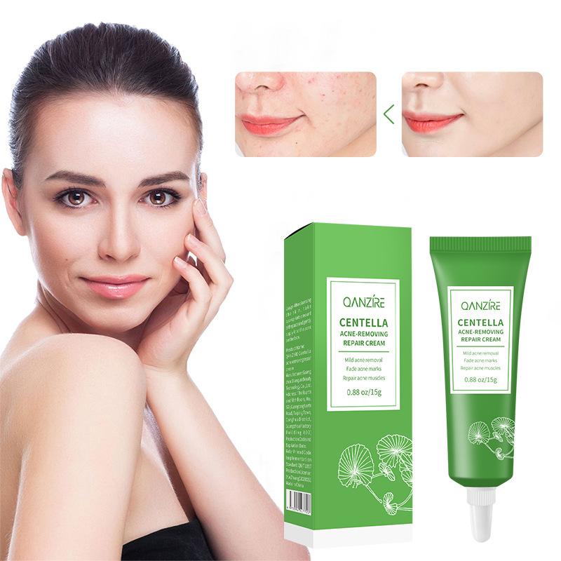 Centella Asiais Acne Cream