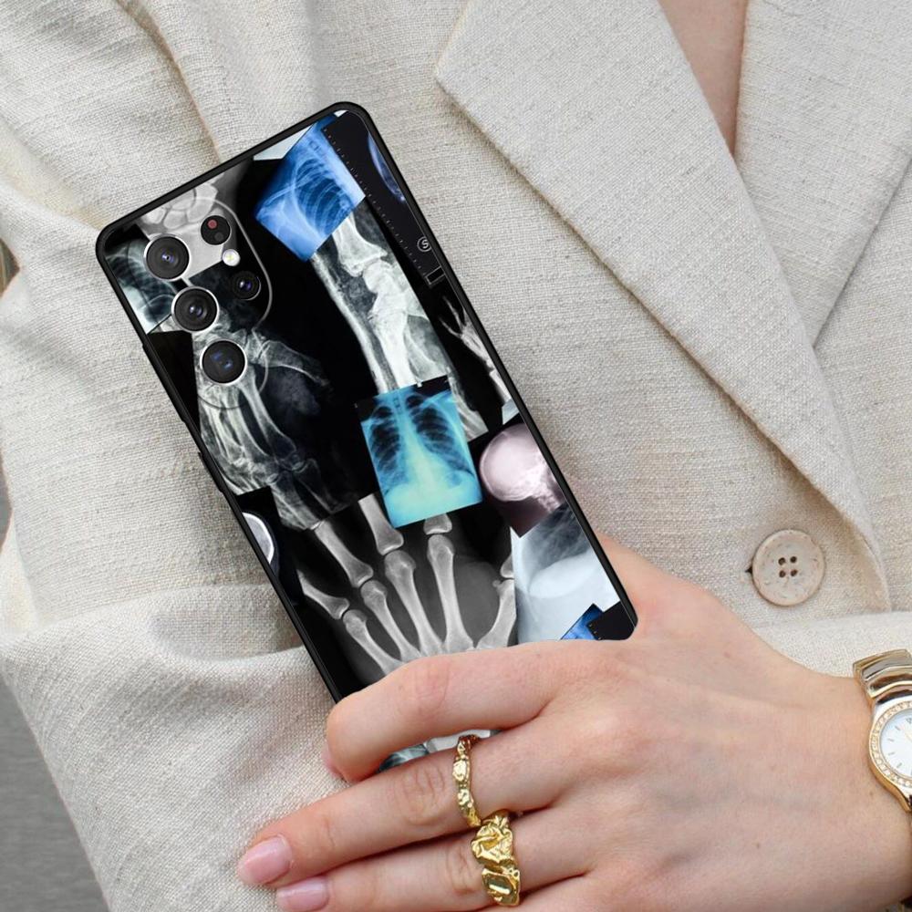 Radiological Human Organs Skeleton Cell Phone Case for Samsung Galaxy S26 Ultra S25 S24 S23 S22 S21 S20 Note10 Cover