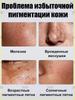 Retiderm anti-aging face cream, Freckle removal and whitening cream is able to remove freckles, chloasma, sunspots, age spots, Contains hyaluroni