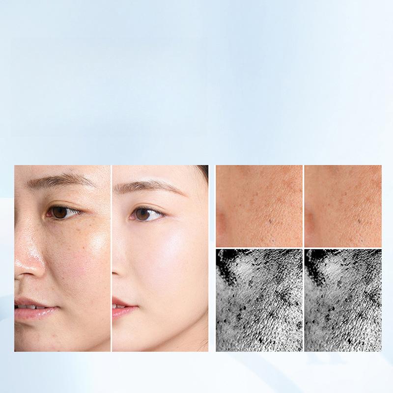 New Colorful LED Phototherapy Black Gold Mask Household Facial Mask Skin Rejuvenation Whitening Oil Removal Neck Instrument Large Row Light