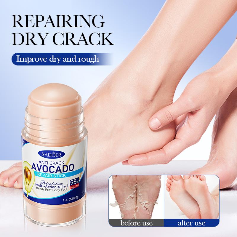 60% Urea Foot Cream Aloe Vera Ultra-hydrating Softening Dry Cracked Feet Cream Gentle Exfoliation Daily Foot Care Solution 40g