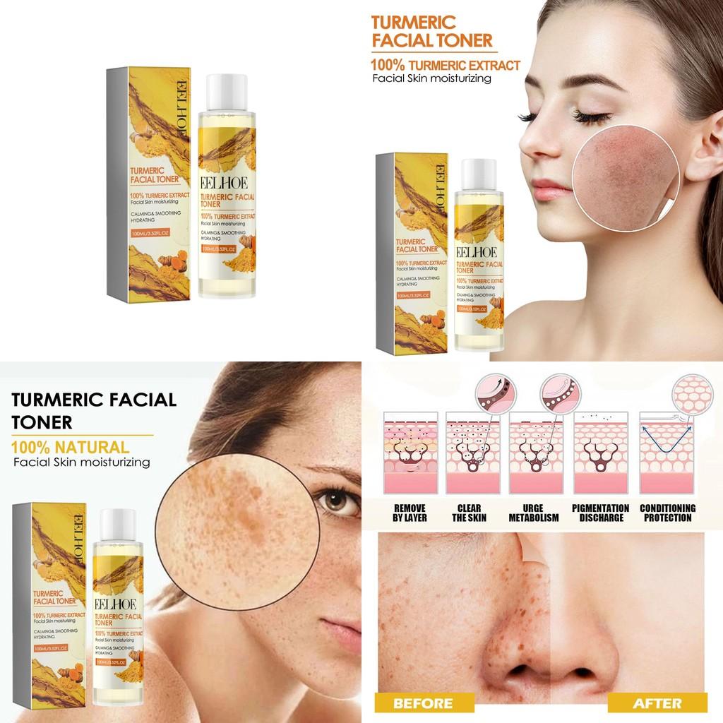 Eelhoe Ginger Turmeric Refreshing Facial Toner Hydrating Moisturizing Pore Refining And Fine Line Smoothing Water 100ml Ideal For Beautiful Skin