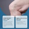 Varicose Vein Relief Cream Leg Massage Care Massage, Blue Veins And Red Blood Vessels  Varicose Veins,  Leg Fatigue And Soreness, Reduce Swelling A