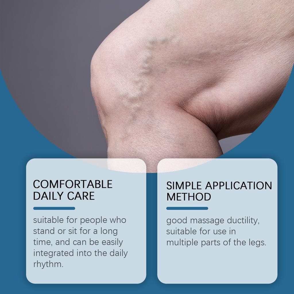 Varicose Vein Relief Cream Leg Massage Care Massage, Blue Veins And Red Blood Vessels  Varicose Veins,  Leg Fatigue And Soreness, Reduce Swelling A
