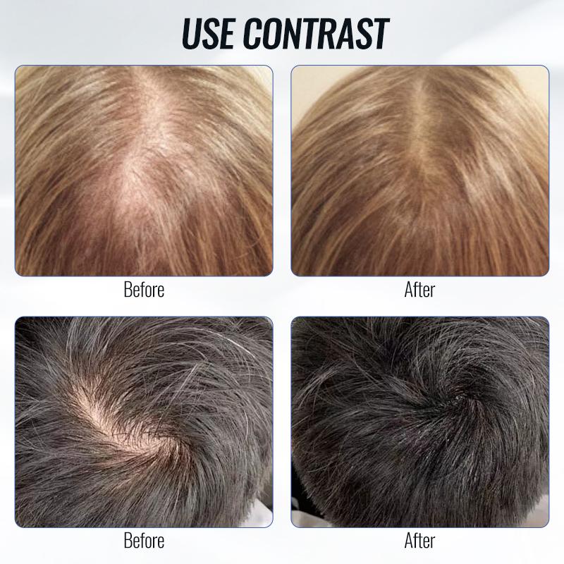 Applicatore per cuoio capelluto Pettine liquido per il trattamento del cuoio capelluto Olio essenziale Spazzola massaggiatrice per la guida Siero per la crescita dei capelli Dispositivo per applicare l'olio