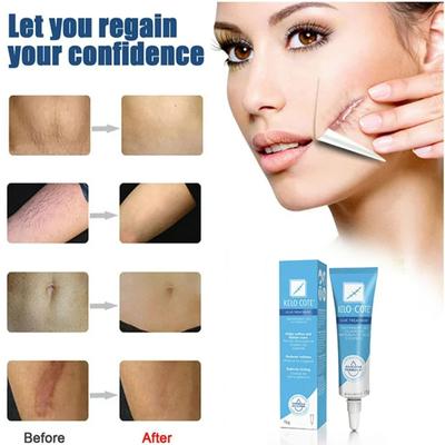 Women's Beauty And Scar Removal Keeps The Face Moisturized And Repairs Damaged Skin Scar Gel 15g
