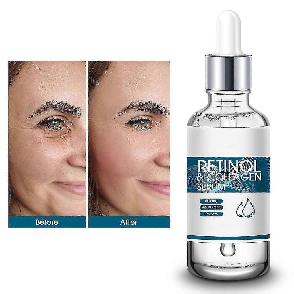 Retinol Serum for Face with Hyaluronic Acid & Collagen, Anti-Aging Face Serum for Women & Men | Reduces Wrinkles, Skin Smoothing, Pore Tightener & Hyd
