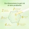 Jaysuing Essential Oil For Gentle Moisturizing And Acne Scar Repair 30ml