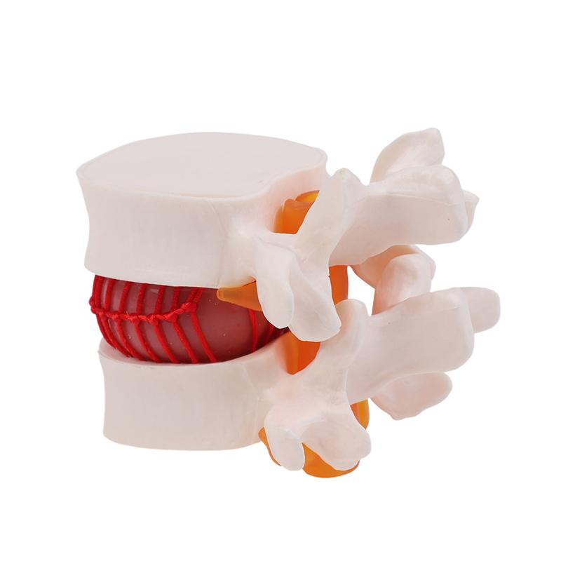 

Анатомія людини Скелет Хребет Поперековий Випадіння диска Навчальна модель Мозок Череп Травматичний Шкільне приладдя Медичний інструмент one size