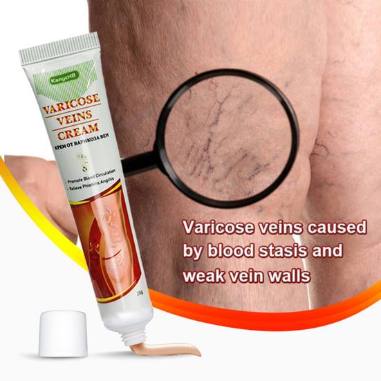 Yousheng 20g Veins Cream Quick Effect Relieve Itching Natural Varicose Vasculitis Phlebitis Spider Cream Plaster for Adult