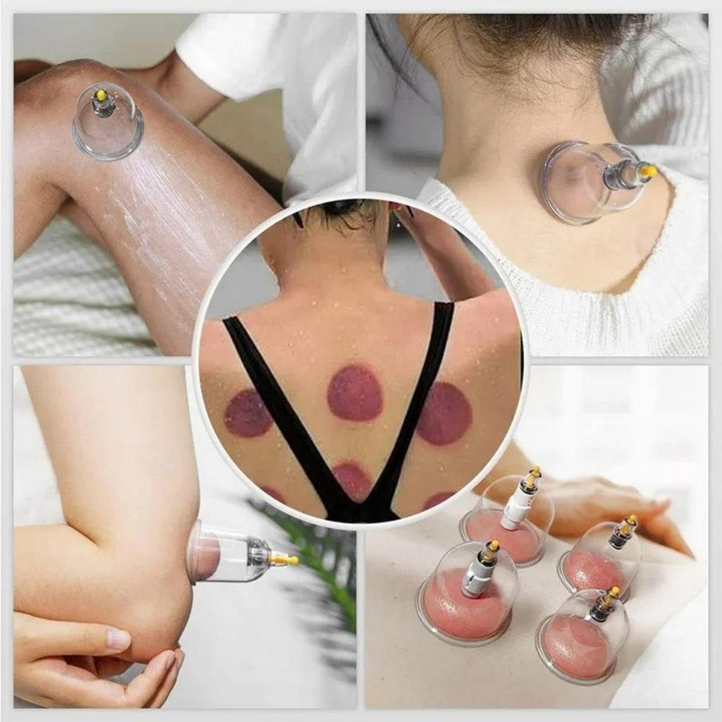 12/22 Cups Cupping Set for Massage Chinese Cupping Kit with Hand Pump Suction Cup Set High-quality Vacuum Cupper