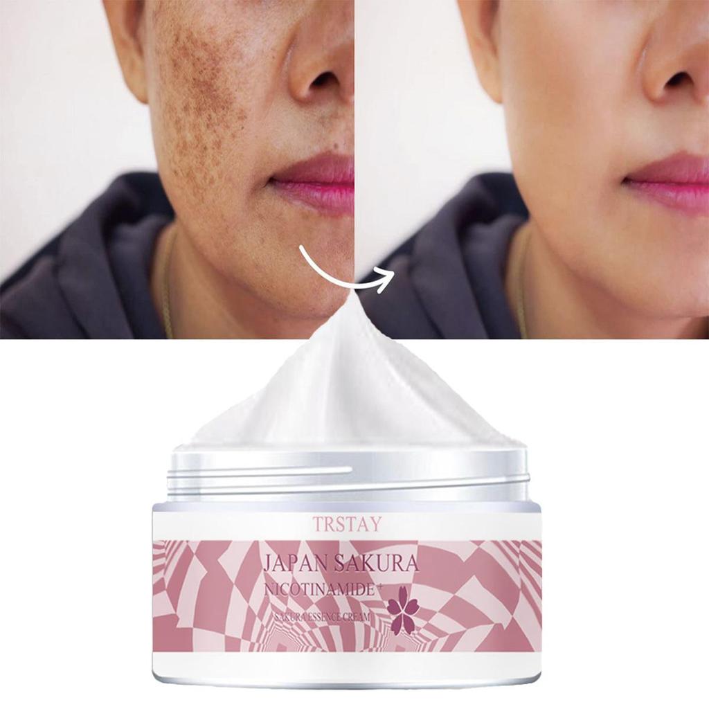 TRSTAY Moisturizing Cream, Vitamin C Brightening Face Cream, Brightening Skin And Lightening Spots