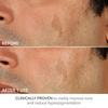 DR. Dennis Gross Skincare Advanced Retinol + Ferulic 0,5 Extra Stärke 8er-Pack