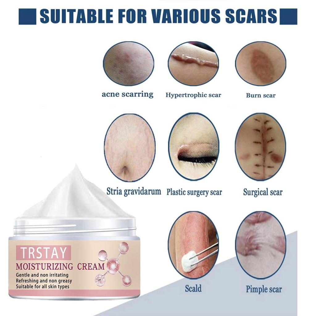 Acne Scar Removal Serum Oil Essential Oils Essence Gel Stretch Marks Treatment Pimples Acne Spots Surgical Scars Burn