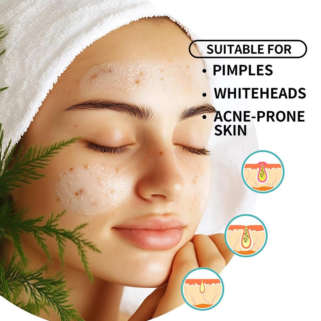 Acne Scar & Pore Serum- Reduce Acne Scars,Shrinks Pores, Balances Oil and Water, Prevents Acne - Suitable for Sensitive Skin, 120ml