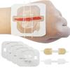 1/3/10/50 Patches Butterfly Closure Bandage Strips Adhesive Strip Stitch Bandages For Closing Skin Wounds With Non-Stick Pad