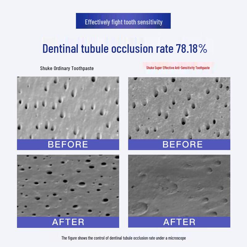 Shuke Anti-Sensitivity Toothpaste