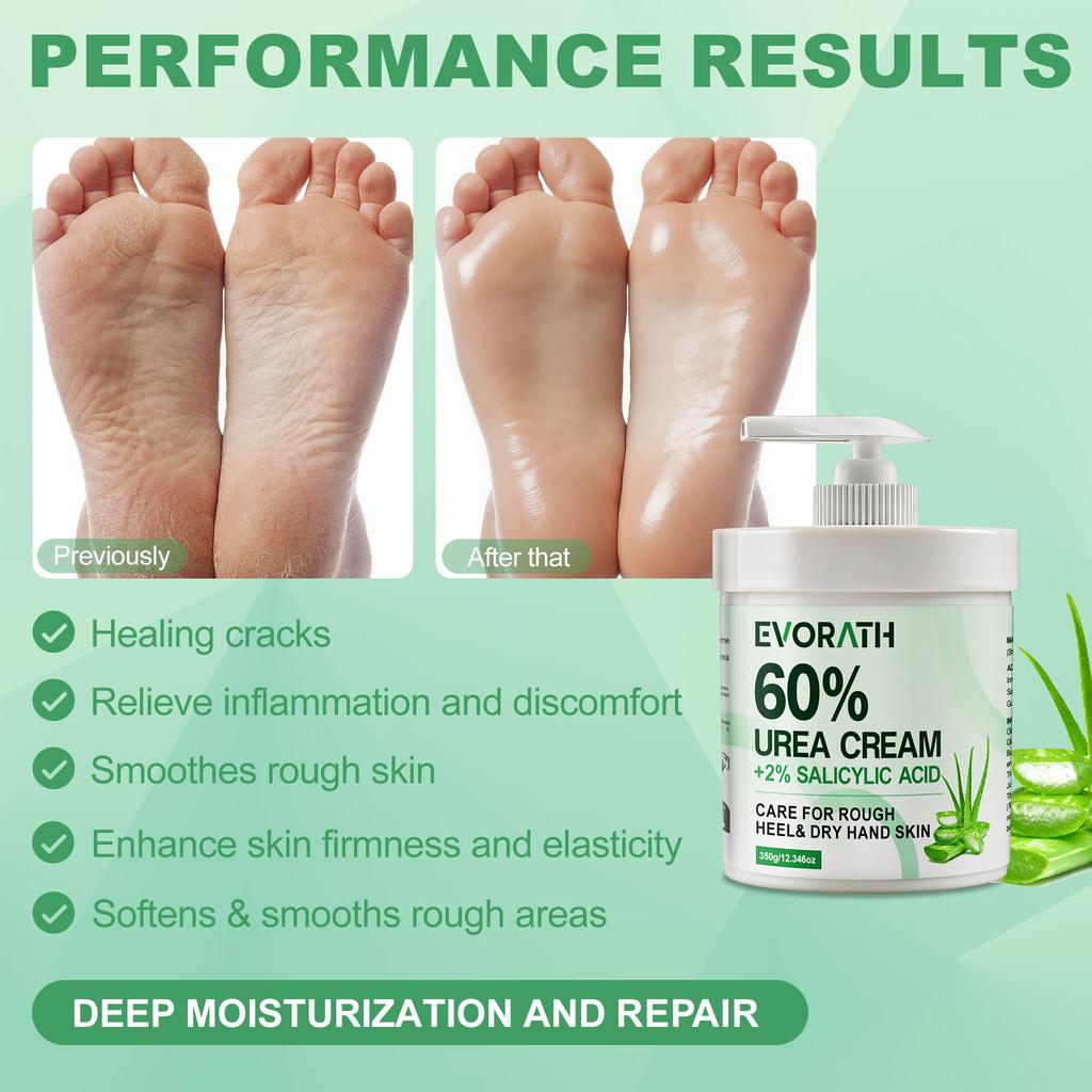 60% Harnstoffcreme mit Aloe Vera, Für trockene, rissige Haut und Hände, Entfernt Hornhaut und macht die Haut weich, Spendet tiefenwirksam Feuchtigkeit 350G