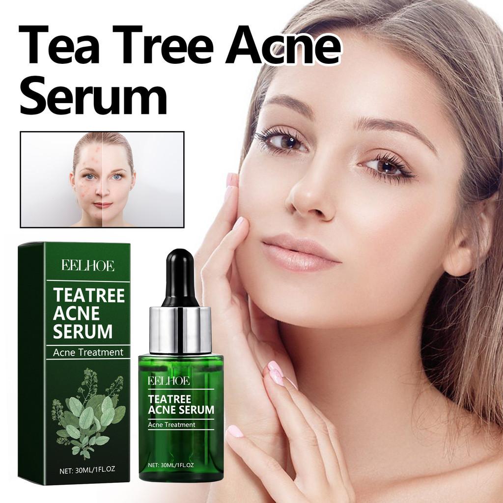 Eelhoe Green Tea Acne Serum Nourishing Antioxidant Formula For Brightening And Moisturizing
