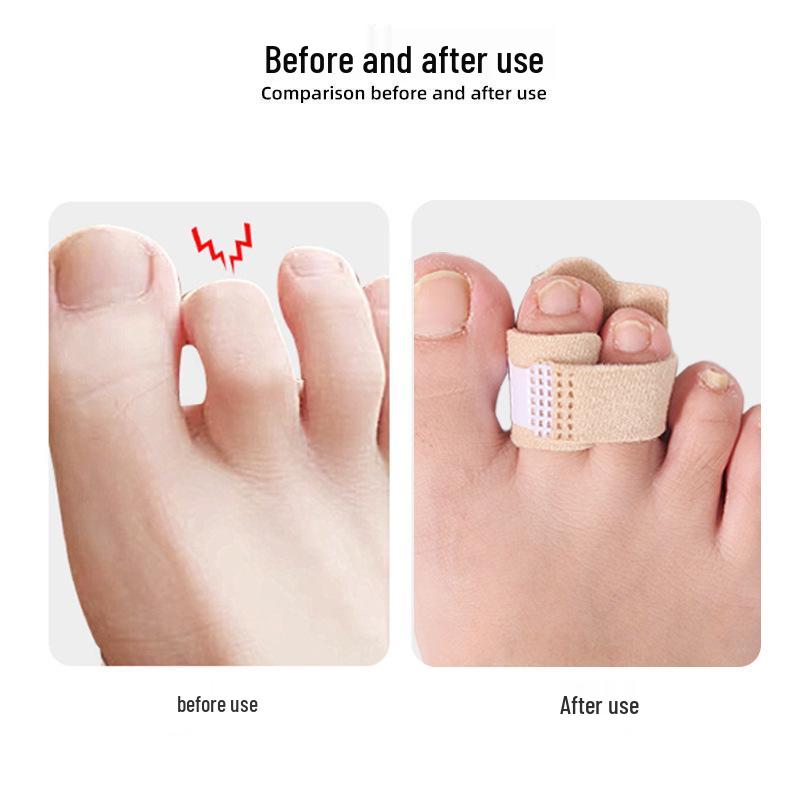 Verstellbarer Ballenzehenkorrekturriemen mit Aluminiumstütze