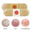 10/20/30/50Pcs Mesh Round Corn Remover Pads Foot Corn-Callus Plaster With Hole Corn Cushions Patches Shoe Foot Care Products
