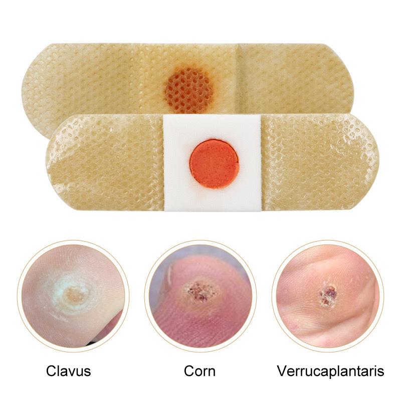10/20/30/50Pcs Mesh Round Corn Remover Pads Foot Corn-Callus Plaster With Hole Corn Cushions Patches Shoe Foot Care Products