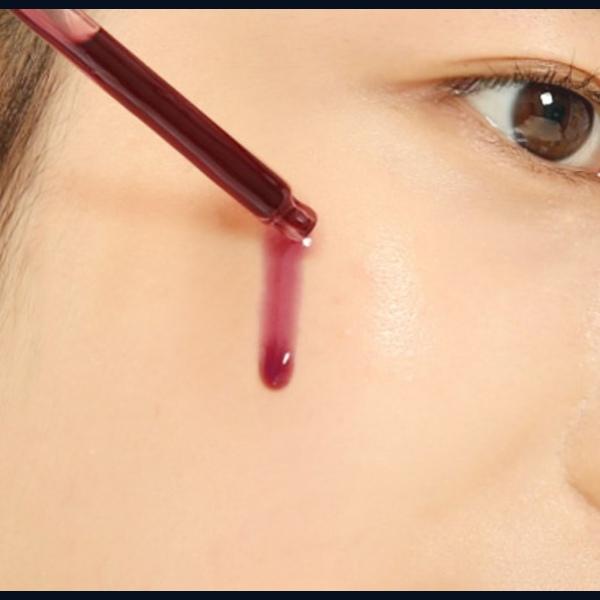 So Natural Red Peel Tingle Serum, 35ml