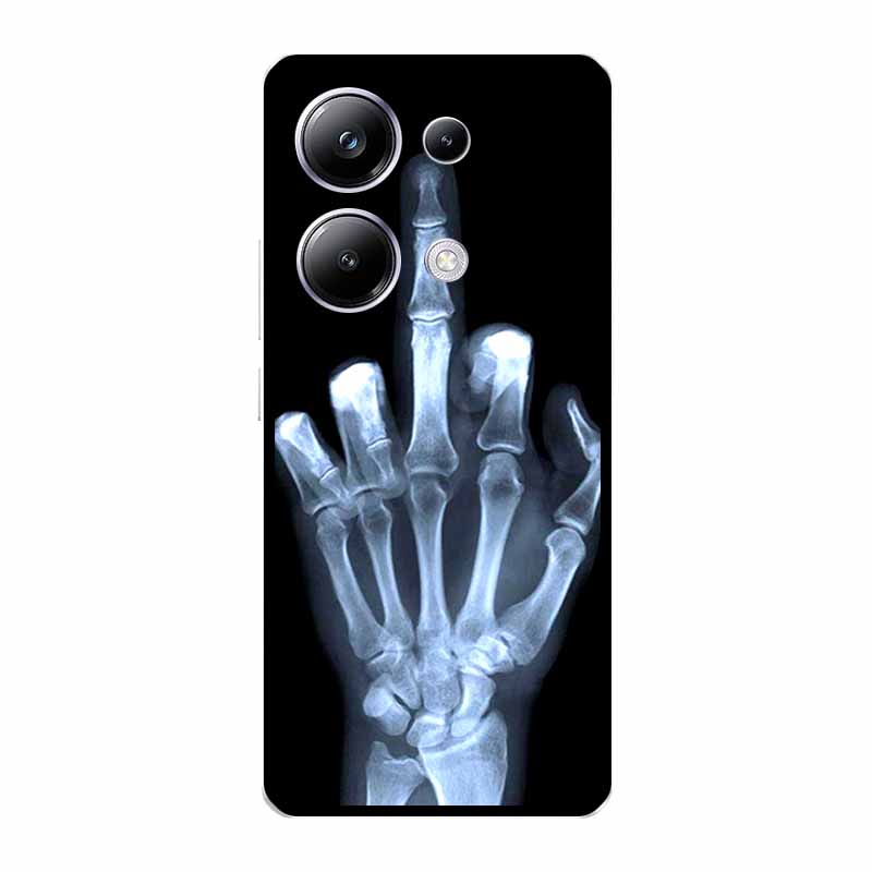 For Redmi Note 13 Pro 5G Cases Note 13 5G 4G Fashion Cool Soft TPU Silicone Phone Covers for Xiaomi Redmi Note 13R Pro 5G Note13