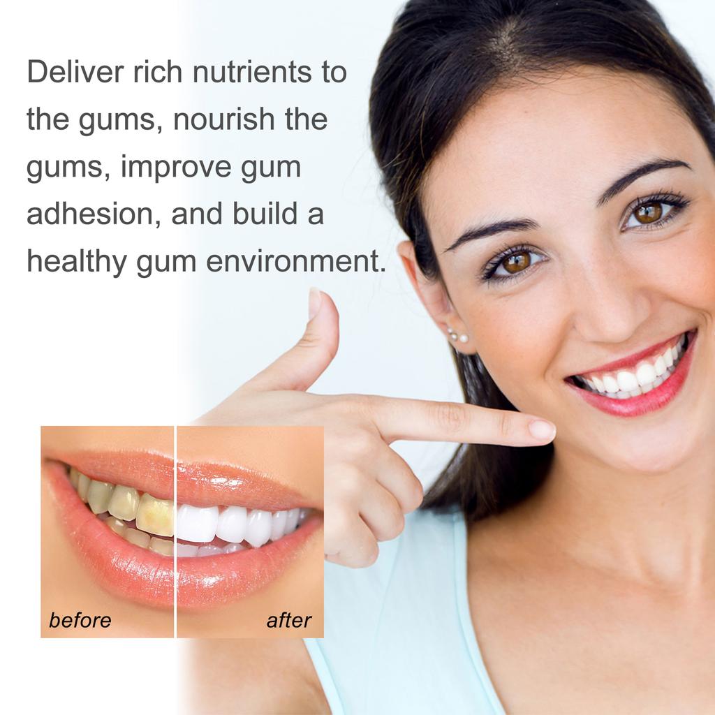 Hyaluronic Acid Gum Repair Care Gel Relieve Sore Gums Allergy Deep Cleaning Teeth Stains Tartar Serum Dental Caries Toothpaste