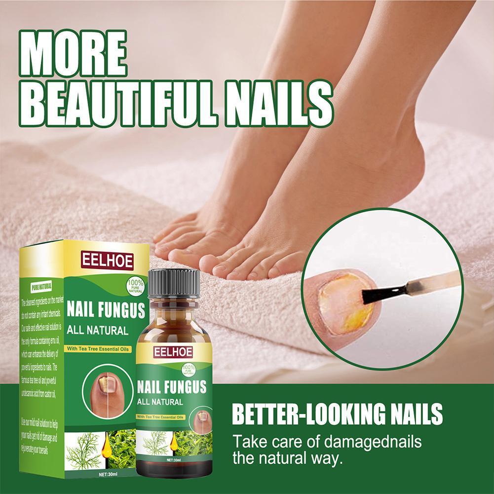 Buy 30ml Nail Fungus Treatment Antifungal Nail Solution Ringworm Clear Healthy Toenail Growth