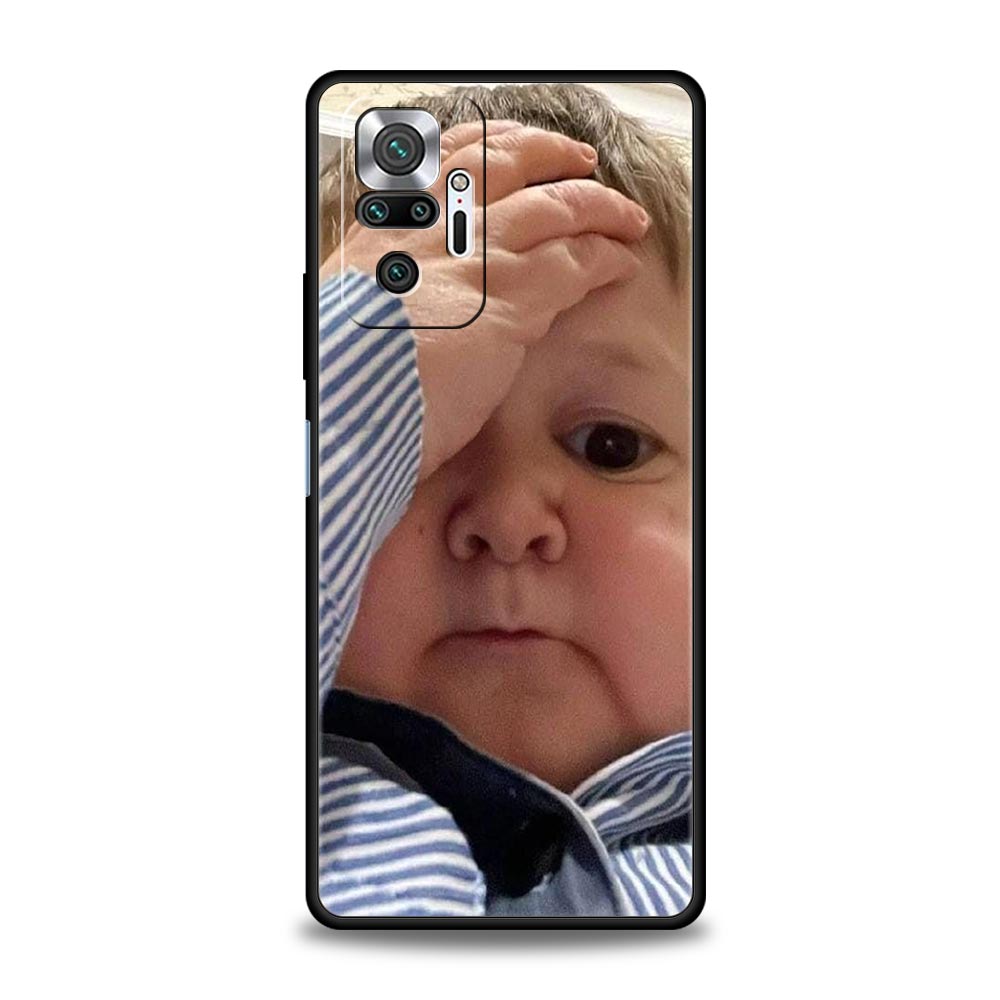Funny Babaite Hasbulla Phone Case For Xiaomi Redmi Note 15 14 13 12 5G 11 10 Pro Plus 4G 9S 14C 13C 12C 10C Soft TPU Cover