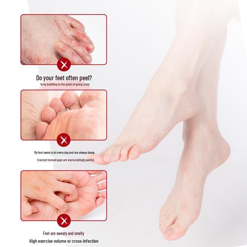 Japanische Athlete's Foot Creme - Antibakteriell, Juckreizlindernd, Schälend, Blasen, Geruchsentferner für Füße & Fußgeruch