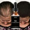 5 ml/15 ml/30 ml/50 ml/Marokkanisches ätherisches Haaröl, pflegt gespaltenes, trockenes und verknotetes, strapaziertes Haar, macht das Haar weich und glänzend